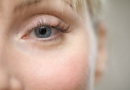 Dažniausiai pasitaikančios akių ligos
