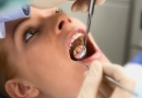 Odontologės konsultacija. Kiek laiko trunka danties protezavimas?