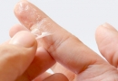 Kaip pašalinti nuo odos superklijus: 5 žingsneliai