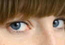 Akių skausmas gali būti rimtos ligos požymis