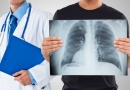 Plaučių ligų diagnostikai ir gydymui Santariškių klinikų medikai pasitelkė šaltį
