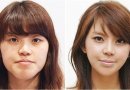 Kaip Pietų Korėjos plastikos chirurgai keičia žmonių išvaizdą (foto)
