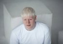 Tokie panašūs, tokie skirtingi: albinosai iš įvairių pasaulio kampelių (foto)