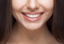 Vietoj spindinčios šypsenos – margi dantys, arba kuo pavojingas neprofesionalus balinimas