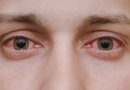4 dažniausiai pasitaikančios akių ligos ir kaip jų išvengti