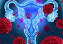 Gydytoja ginekologė: kodėl svarbu reguliariai tirtis dėl gimdos kaklelio vėžio?