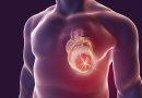 Gydytojų perspėjimas sergantiems širdies ligomis: nenustokite tai daryti – pasekmės gali būti skaudžios