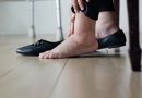 Tinstančios kojos – rimtų ligų pranašas: reumatologė įvardijo galimas priežastis