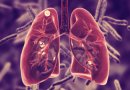 6 simptomai, įspėjantys apie plaučių ligą