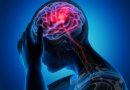 Ar skirtingi galvos skausmai reikalauja skirtingo gydymo? 