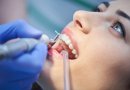 Su šia problema susiduriame visi: gydytojas papasakojo, kaip išvengti dantų dilimo