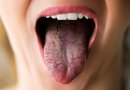Šio įkyraus simptomo ignoruoti ne valia: štai, ką išduoda burnos džiūvimas