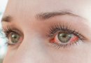 Įspėja neignoruoti akių perštėjimo: išduoda pavojingą ligą