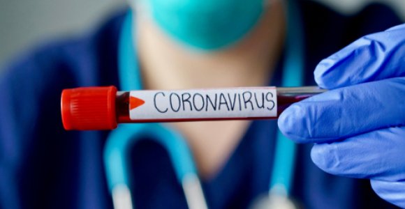 Patvirtintų sergančiųjų koronavirusu skaičius Lietuvoje pasiekė 160