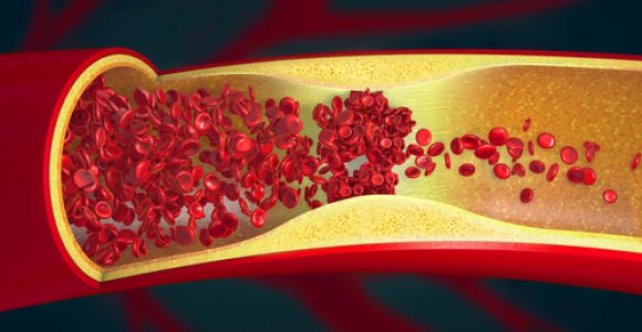 Netikėtas simptomas išdavė pragaištingą diagnozę: pacientę išgelbėjo operacija